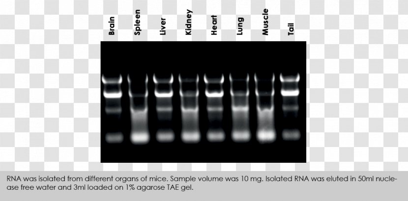 RNA Extraction Gel Electrophoresis Buffer Solution - Dna Polymerase - Disinfection And Purification Of Blood Mycoplasma Transparent PNG