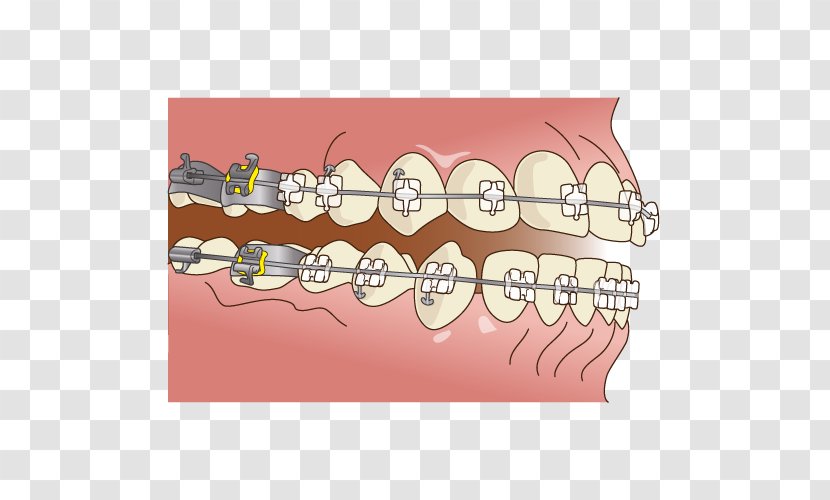 Dentistry 矯正歯科 Dental Braces - Flower Transparent PNG
