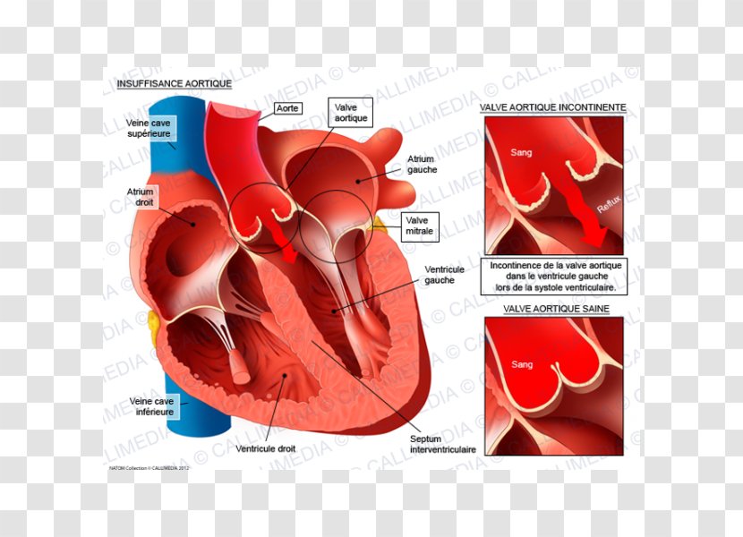 Aortic Insufficiency Valvular Stenosis Valve Aorta Mitral - Watercolor - Heart Transparent PNG