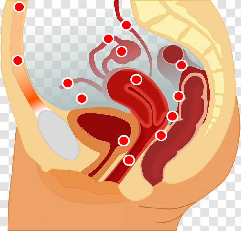 Endometriosis Endometrium Pelvic Pain Uterus Disease - Tree - Internal Organs Transparent PNG
