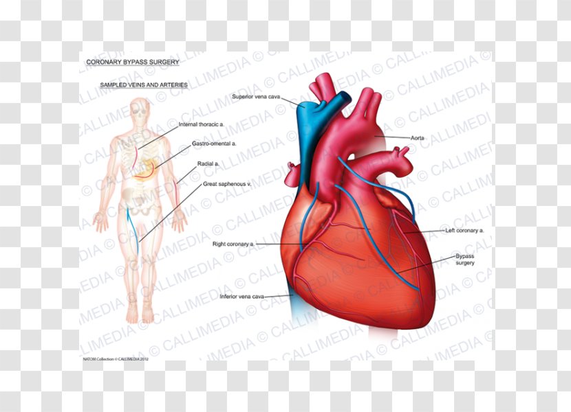 Heart Disease: A Textbook Of Cardiovascular Medicine Anatomy Coronary Artery Disease Cardiology Transparent PNG