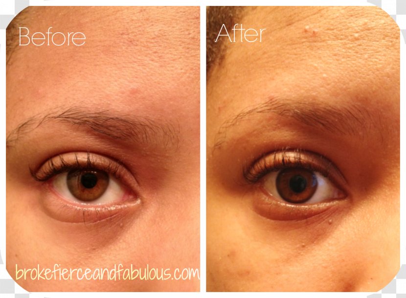 Eyelash Extensions Mascara Eye Shadow Liner - Forehead - Before And After Transparent PNG