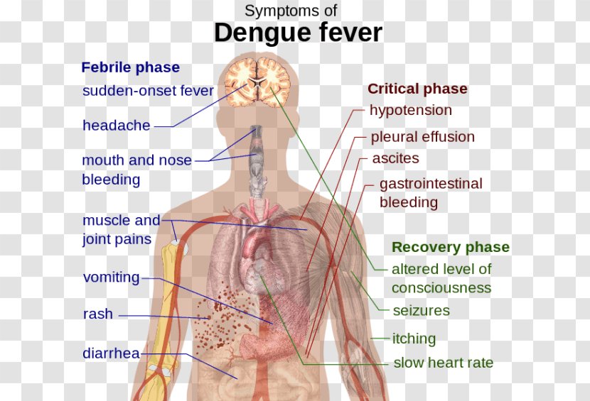 Dengue Virus Viral Hemorrhagic Fever Symptom - Frame - Watercolor Transparent PNG