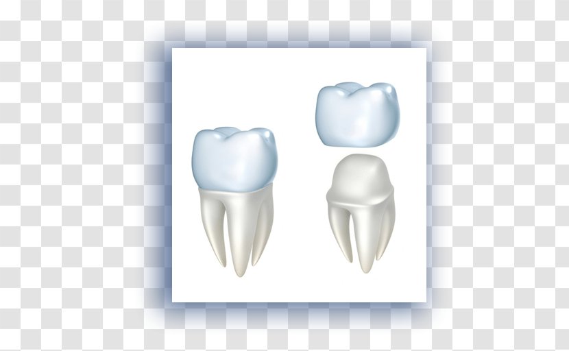 Crown Dentistry Dental Restoration Implant - Heart - Damaged Tooth Transparent PNG