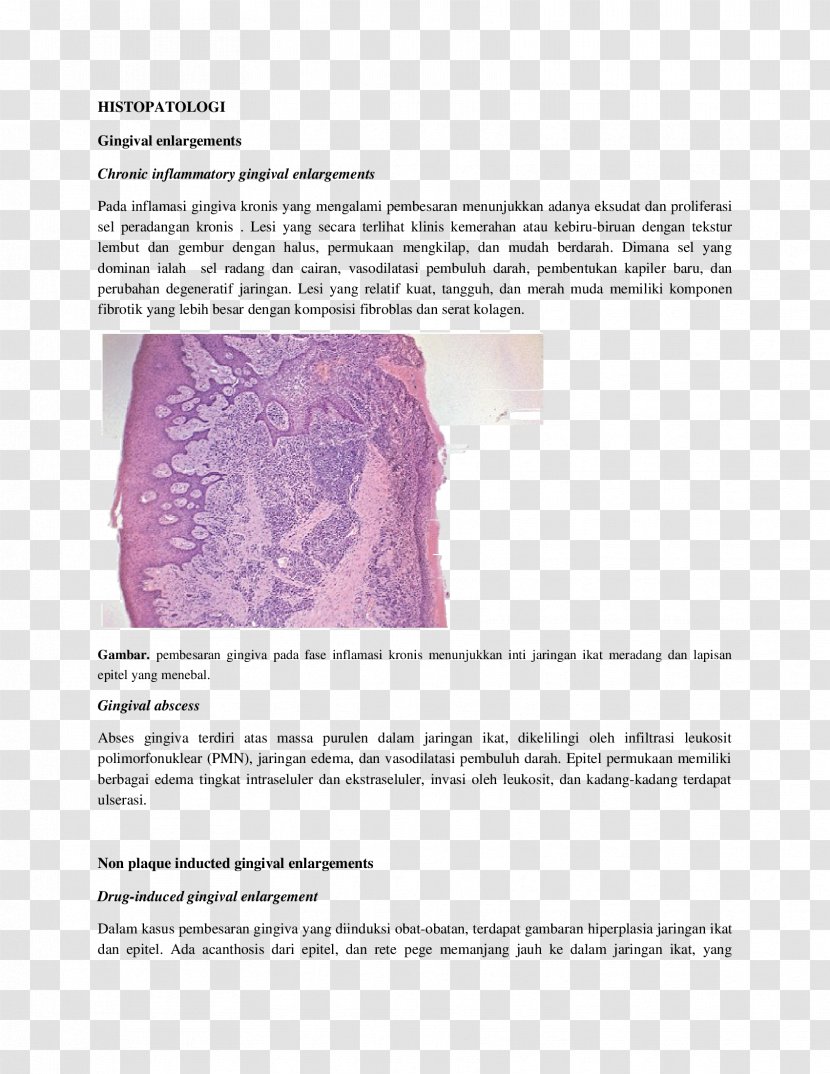 Inflammation Proliferasi Exudate Histopathology Cell - Gingival Bleeding Transparent PNG
