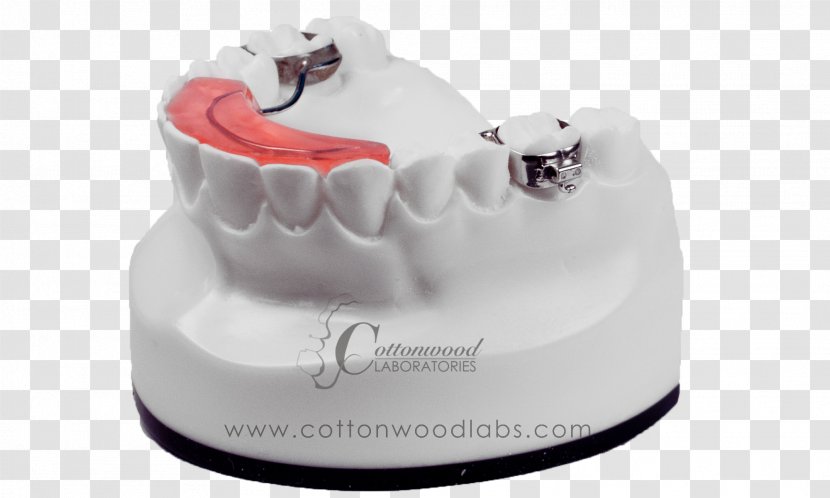Biting Tooth Behavior Dentistry - Orthodontics - Digital Appliances Transparent PNG