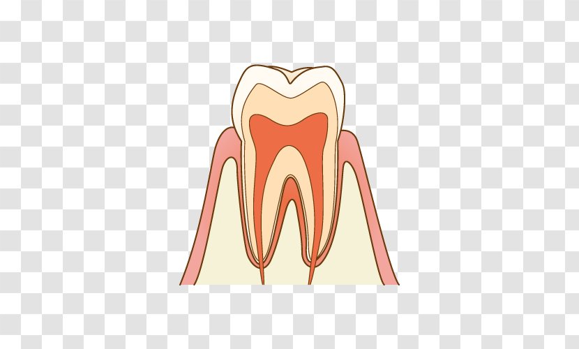 Tooth Decay Dentist 歯科 Therapy - Frame - Illust Transparent PNG