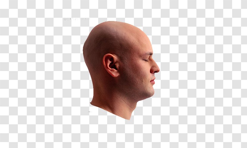 Botak Hair Loss Head Skin - Facial - Man Side Face Transparent PNG