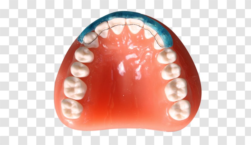 Digital Dentistry Diagnostic Wax-up CAD/CAM Tooth - Cadcam - Damon Transparent PNG