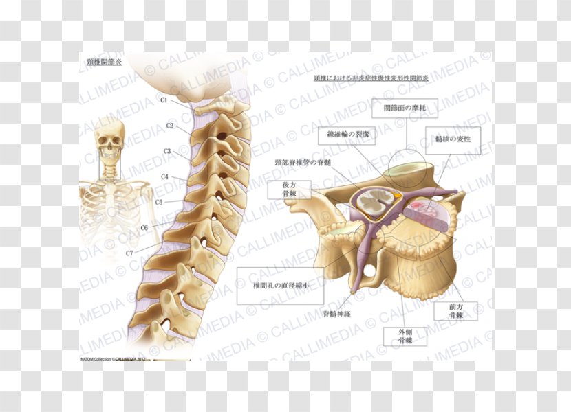 Cervical Osteoarthritis Vertebrae Pain - Watercolor - Collar Transparent PNG