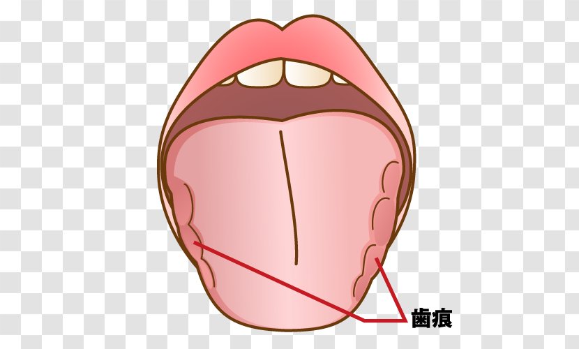 Mouth Dentist Jaw Tooth 坂井歯科医院 - Tree - Captions Transparent PNG