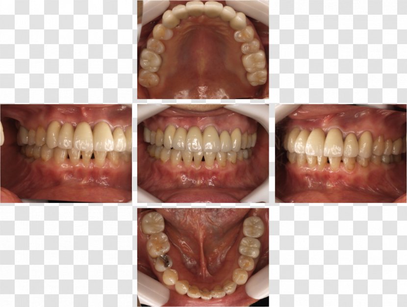 Dentist 矯正歯科 Therapy Dental Braces Jaw - Yamato - Hashimotokyosei Clinic Transparent PNG