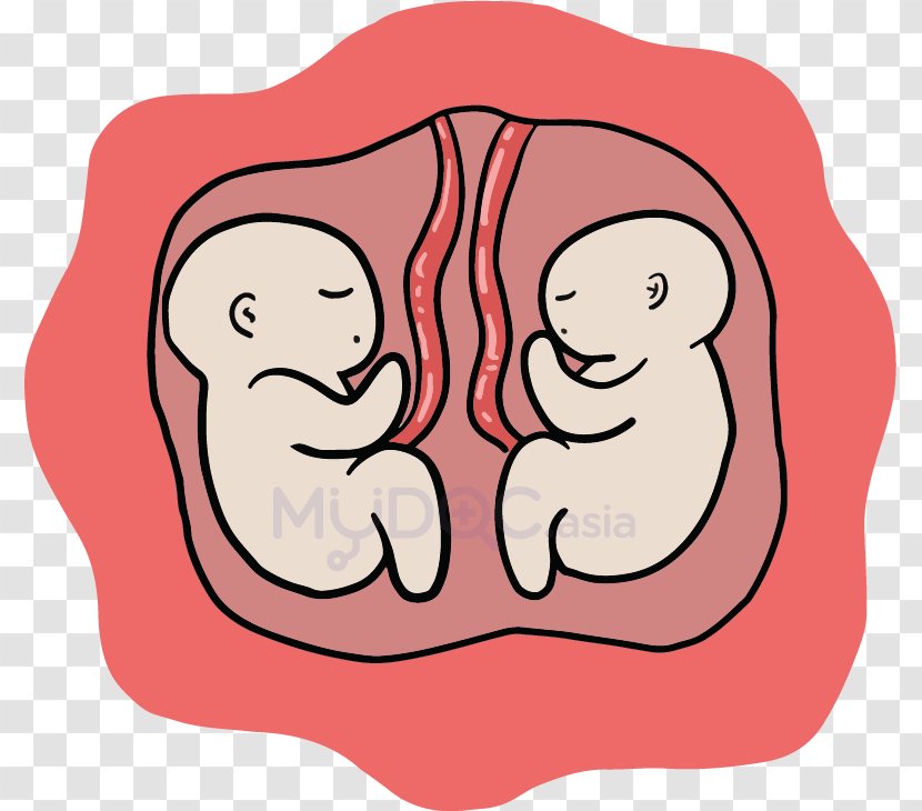 Caesarean Section Birth Mother Twin Pregnancy - Heart Transparent PNG