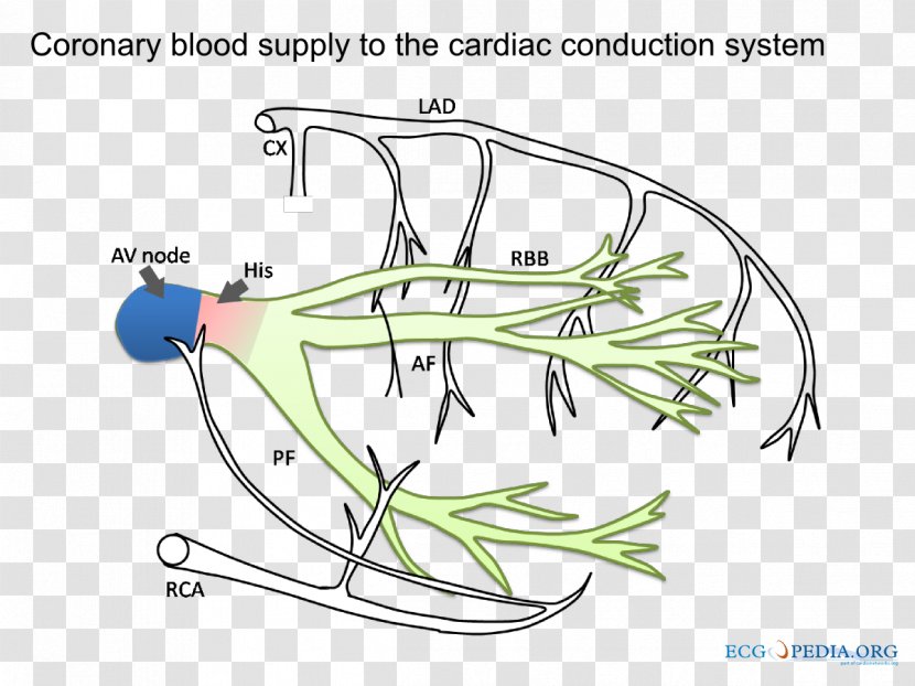 Ischemia Cardiac Muscle Coronary Artery Disease Acute Myocardial Infarction Nutrient - Flower - Cartoon Transparent PNG
