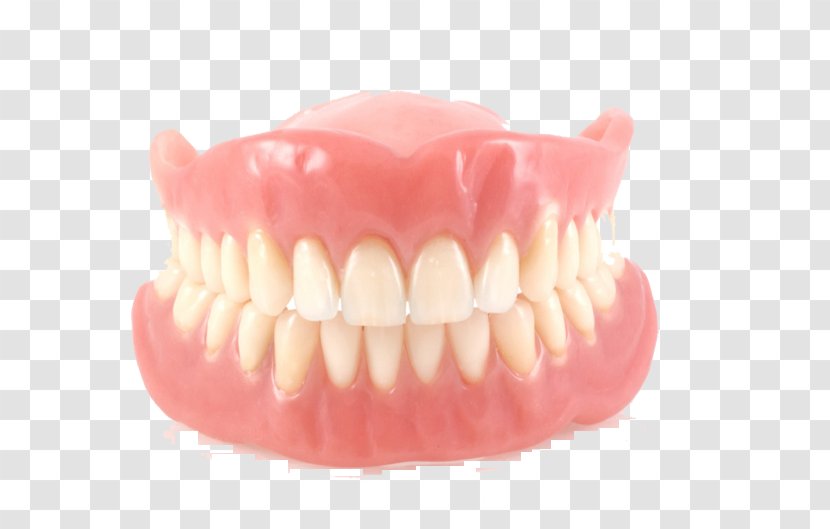 Dentures Removable Partial Denture Dentistry Dental Implant Laboratory - Crown Transparent PNG