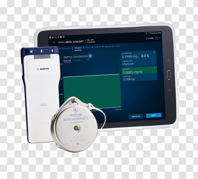 Medtronic Intrathecal Pump Infusion Pain Management Chronic - Gadget Transparent PNG