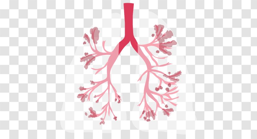 Chronic Obstructive Pulmonary Disease Bronchitis Health Lung Irritable Bowel Syndrome - Smoking Transparent PNG