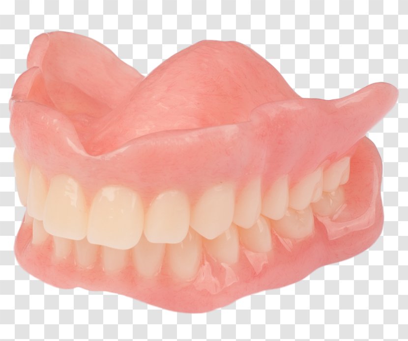 Tooth Dentures AvaDent Art Analog Signal - Dentistry At The Springs Transparent PNG
