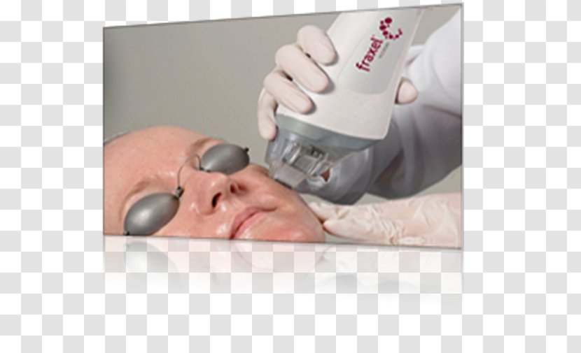 Fraxel Low-level Laser Therapy Facial Rejuvenation - Dermatology - Ophthalmology Transparent PNG