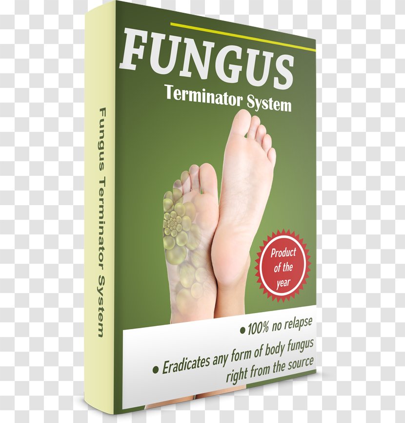 Foot Onychomycosis Nail Fungus - Cartoon Transparent PNG