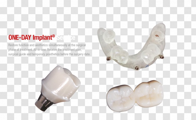 Dental Implant Abutment Temporary Crown CAD/CAM Dentistry - Plastic - Implants Transparent PNG