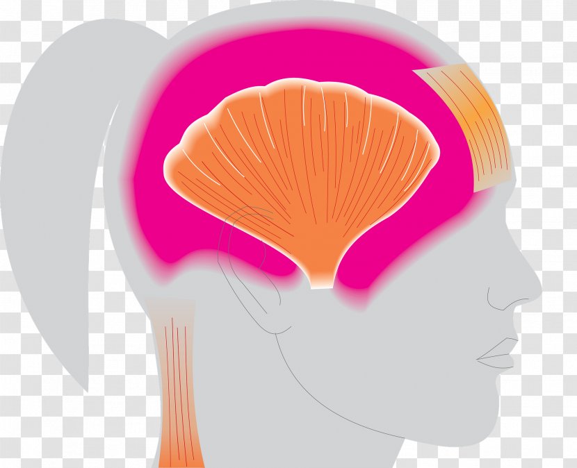 Migraine Headache Symptom Disease Therapy - Heart - Hijama Pain Relief Transparent PNG