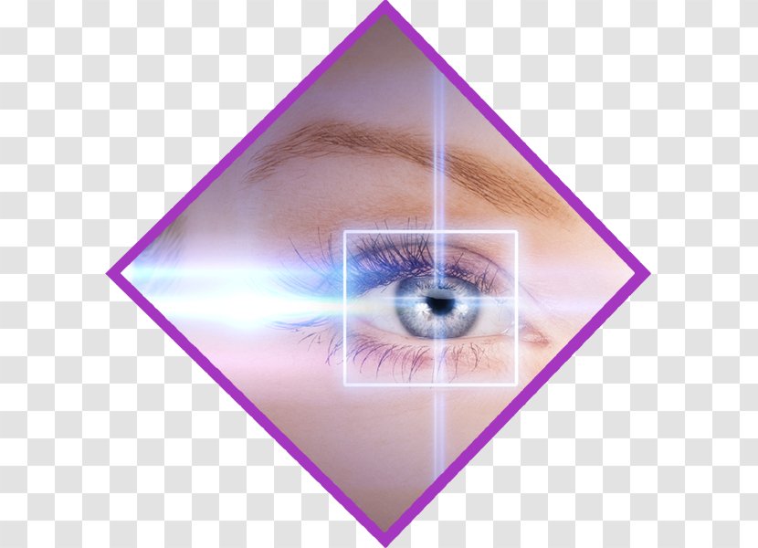 LASIK Eye Surgery Cataract - Drops Lubricants - Laser Transparent PNG