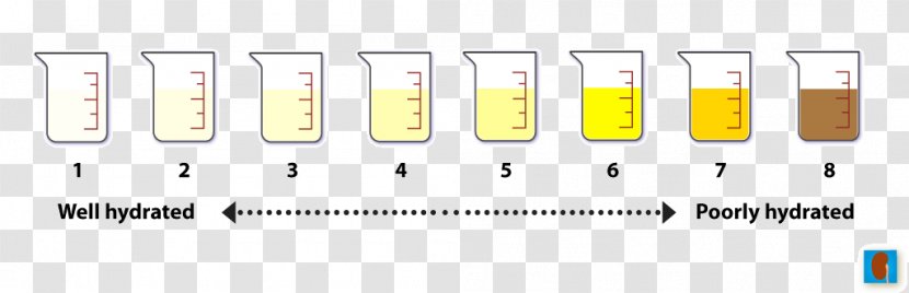 Dehydration Diet Kidney Water Retention Diabetes Insipidus - Symptom - Urine Test Transparent PNG