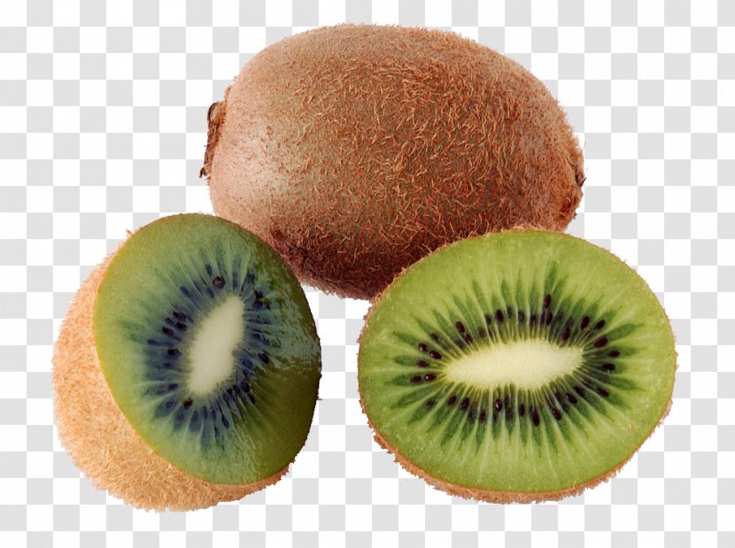 Kiwifruit Sapodilla Food Health - Pineapple - Kiwi Slice Transparent PNG