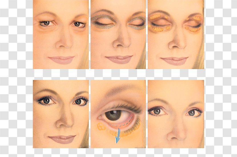 Blepharoplasty Eyelid Surgery Periorbital Puffiness - Jaw - Biomedical Cosmetic Transparent PNG