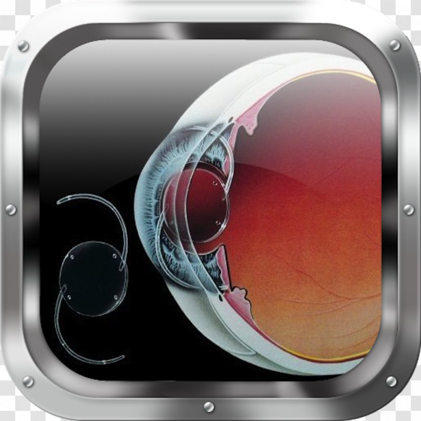 Intraocular Lens Retinal Detachment Cataract Surgery - Audio - Eye Transparent PNG