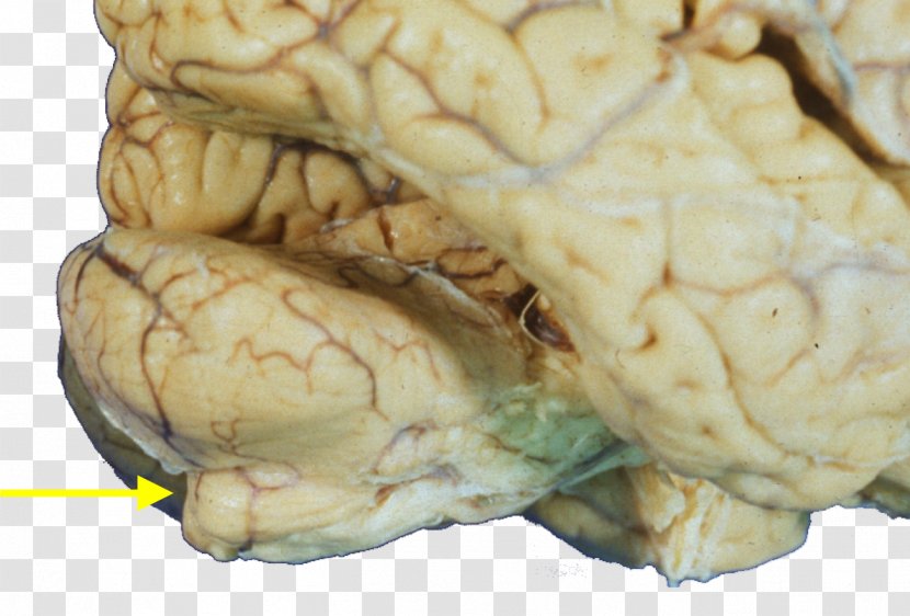 Brain - Frame - Cartoon Transparent PNG