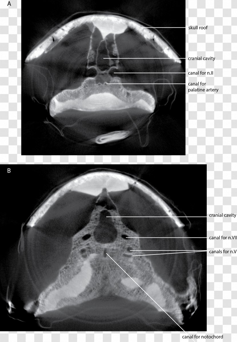 Computed Tomography Dipnorhynchus Skull Lungfish Endocast - Medical Imaging - CT Scan Transparent PNG