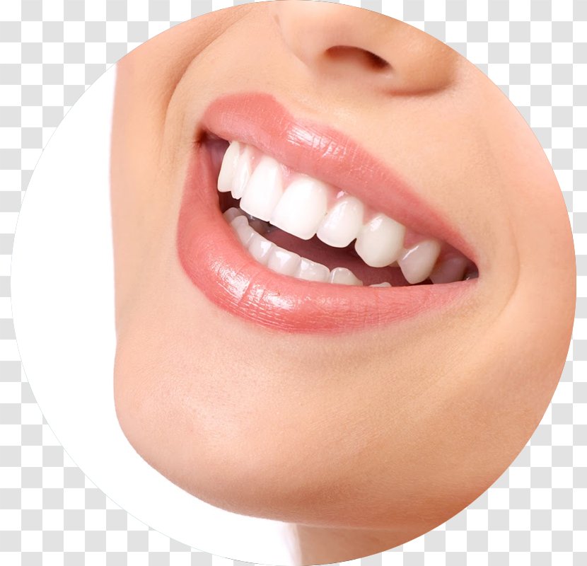Tooth Whitening Dentistry Human - Dental Surgery - Bridge Transparent PNG