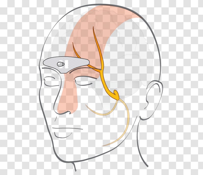 Ear Forehead Cefaly Electrode Migraine - Silhouette Transparent PNG