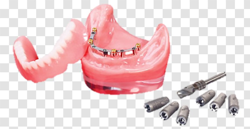 Utica Plastic Dental Laboratory - Consonant Transparent PNG