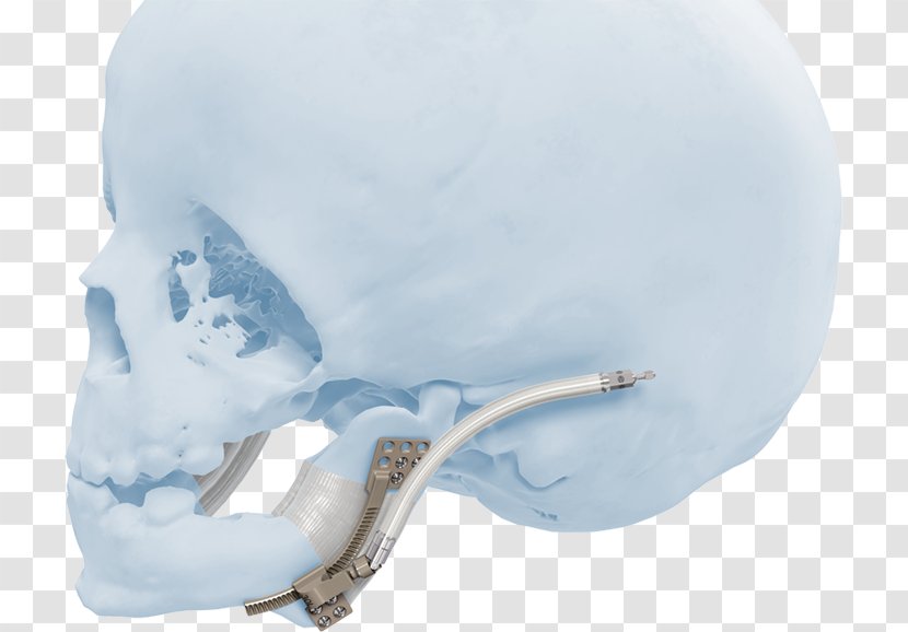 Skull Product Design Ice - Tree Transparent PNG