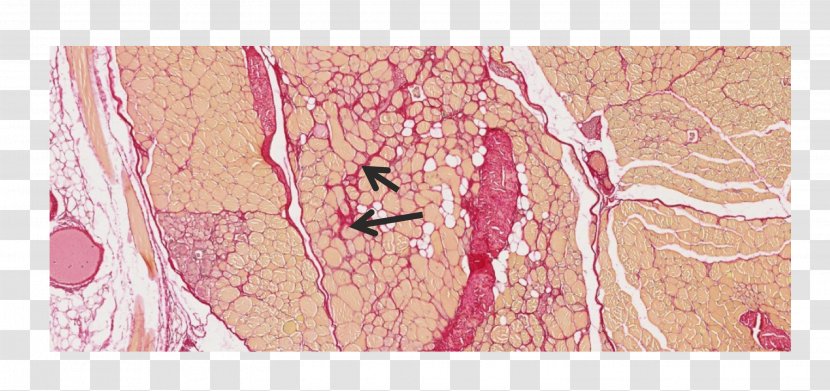 Blood Vessel Pink M Art RTV - Tree - Skeletal Muscle Transparent PNG