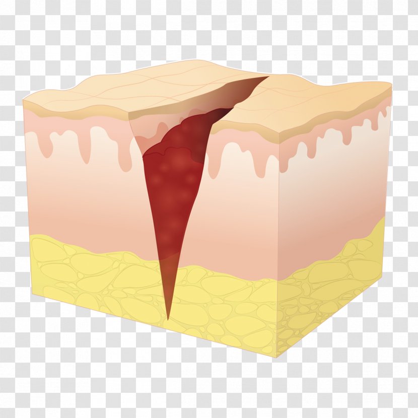 Product Design Table - Cupcake - Healing Cartoon Wound Transparent PNG