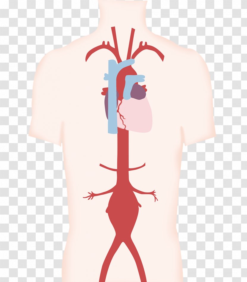 Aneurysm Artery Blood Vessel Aorta Thumb - Silhouette - Heart Transparent PNG