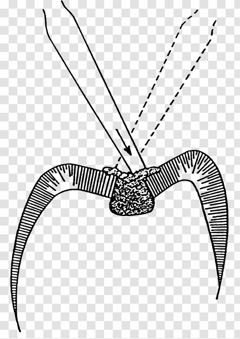 Amalgam Tooth Decay Dental Floss Enamel Therapist - Artwork - Effect Chart Of Restoration Transparent PNG