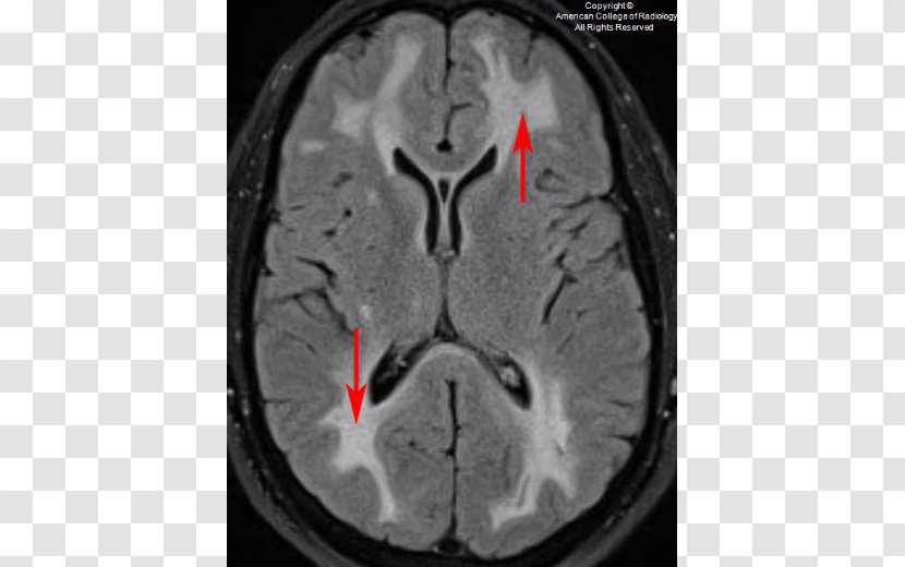 Computed Tomography Brain Font - Cartoon Transparent PNG