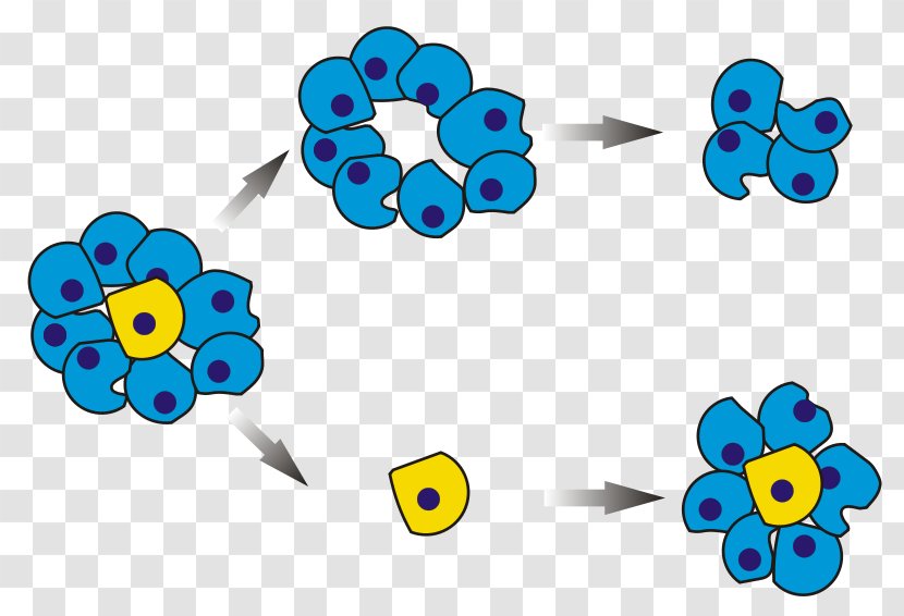 Cancer Stem Cell Neoplasm - Acute Lymphoblastic Leukemia Transparent PNG