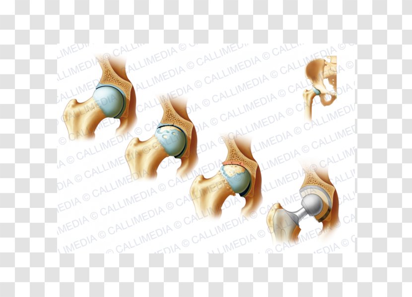 Bone Fracture Cat Arthritis Clavicle Rheumatology - Jewellery Transparent PNG