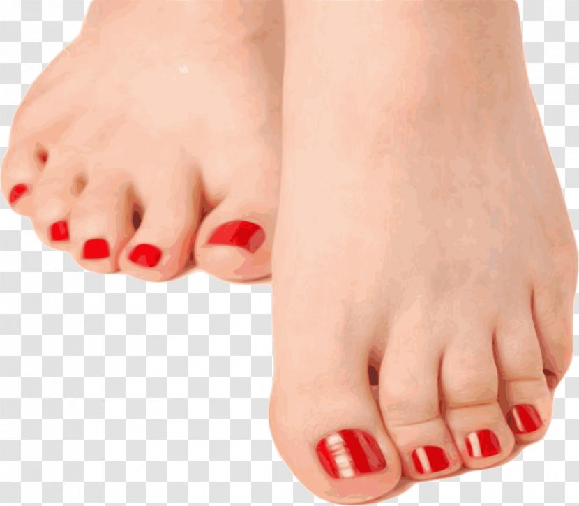 Hammer Toe Nail Foot Onychomycosis - Tree - Sore Transparent PNG