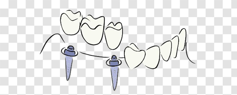 Balaguer Therapy Clinic Health Prosthesis - Cartoon - Dentist Transparent PNG