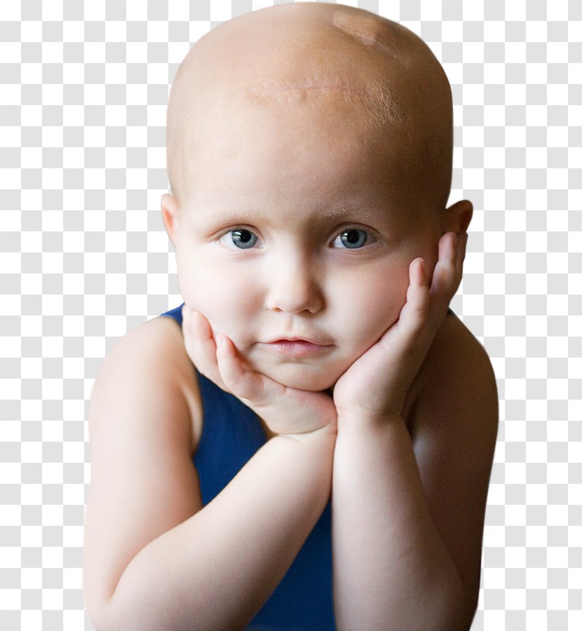 Childhood Cancer Pediatrics Toddler - Therapy Transparent PNG