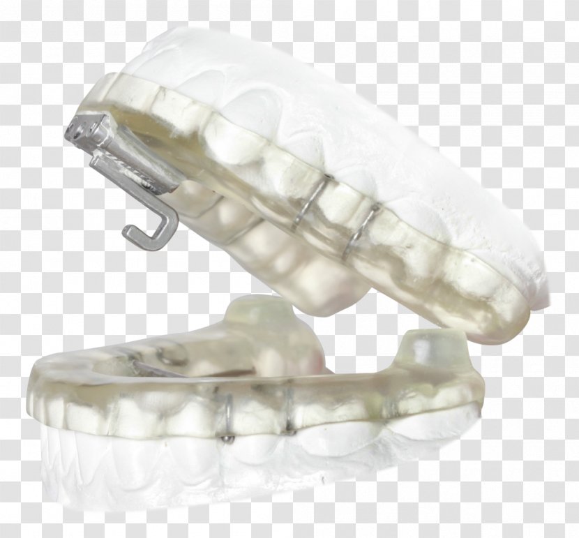 Mandibular Advancement Splint Obstructive Sleep Apnea Temporomandibular Joint Dysfunction - Orthodontic Technology - Orthodontics Transparent PNG