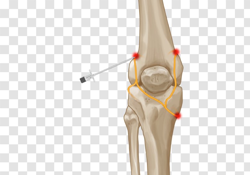 Knee Pain Thumb Joint Hip - Human Leg - Cambridge Consultants Transparent PNG