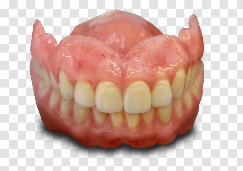Tooth Dentures Dentistry Dental Implant Laboratory - Dentist Transparent PNG